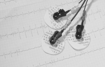 ECG electrode gel